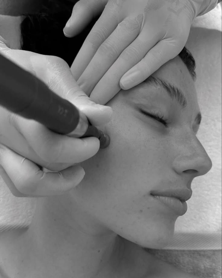 Hydrafacial Gesicht 