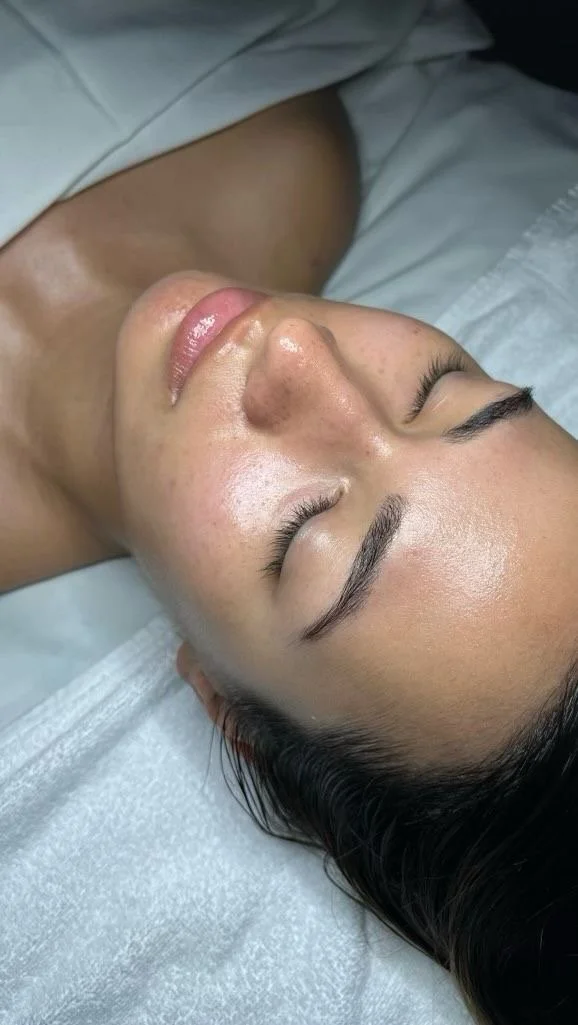 Hydrafacial Glow nach der Behandlung mit strahlender und verfeinerter Haut