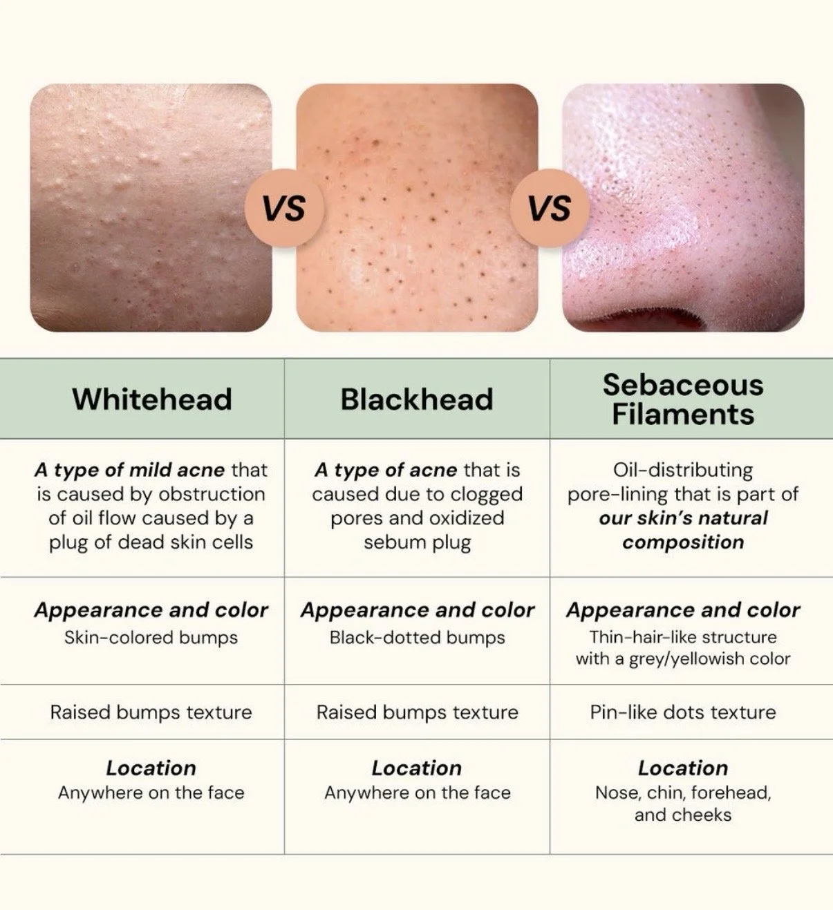 Tabelle mit Hautunreinheiten wie Whiteheads, Blackheads und Sebaceous Filaments mit Erklärung zu Ursache, Erscheinungsbild, Farbe und typischen Hautbereichen im Gesicht.