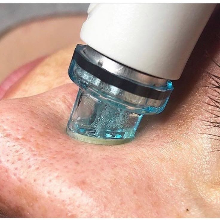 Hydrafacial Behandlung mit Wirkstoffinfusion für hydratisierte und strahlende Haut