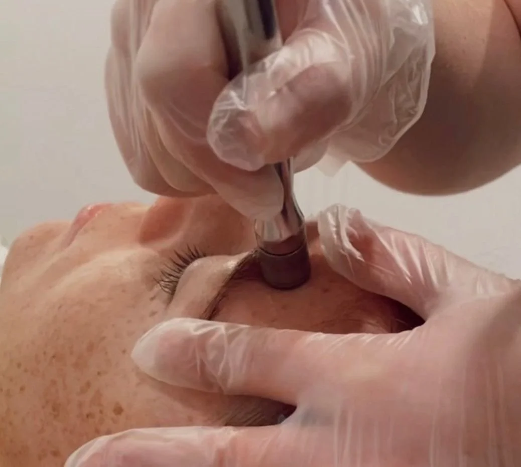 Microdermabrasion Hamburg Behandlung für sanfte Hauterneuerung in Hamburg