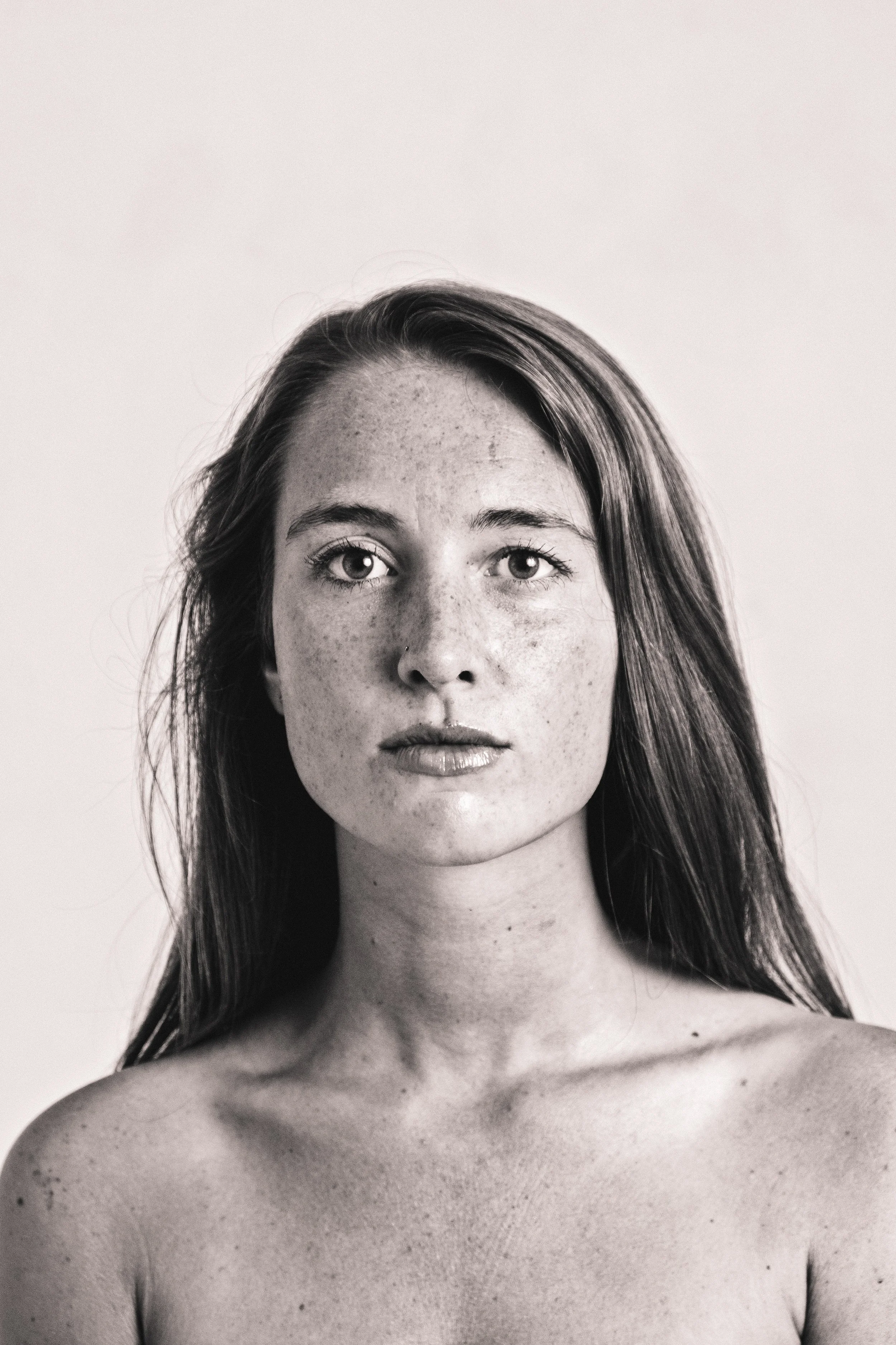 Microneedling und Microdermabrasion zur Verbesserung von Poren, Pigmentflecken und feinen Linien