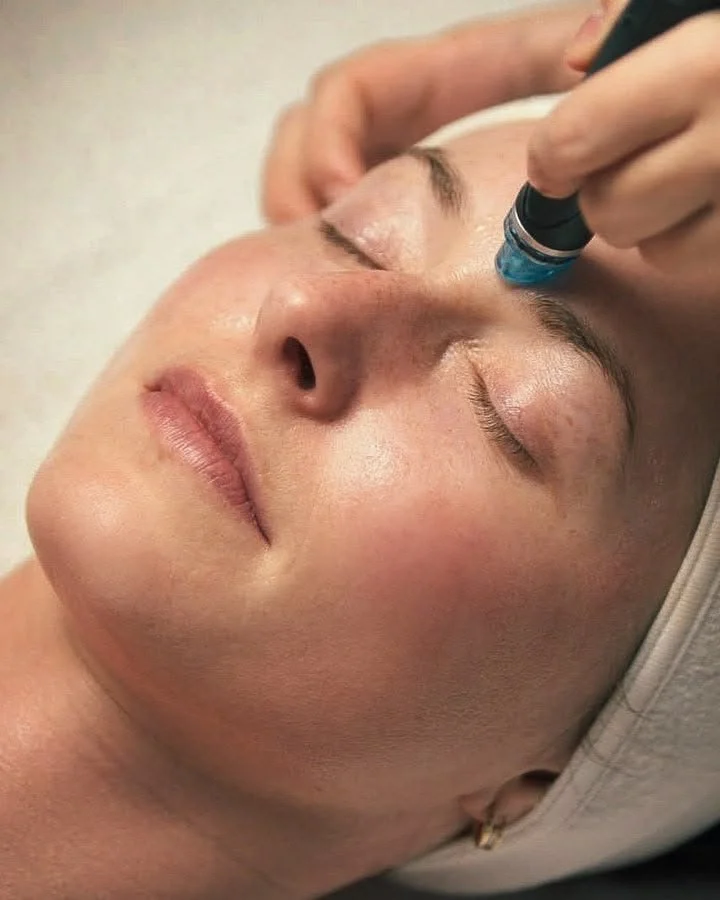Hydrafacial bei trockener Haut