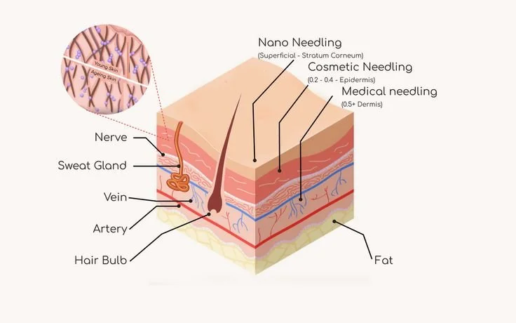 Grafische Darstellung der Eindringtiefe von Nano Needling, kosmetischem und medizinischem Microneedling in verschiedenen Hautschichten.