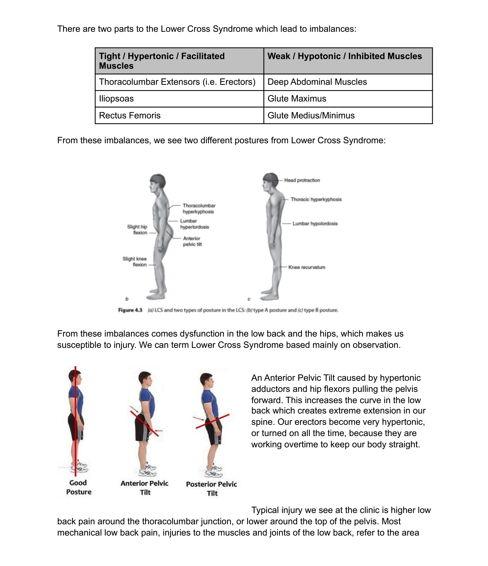 Overuse Injuries - Low Back-2.png