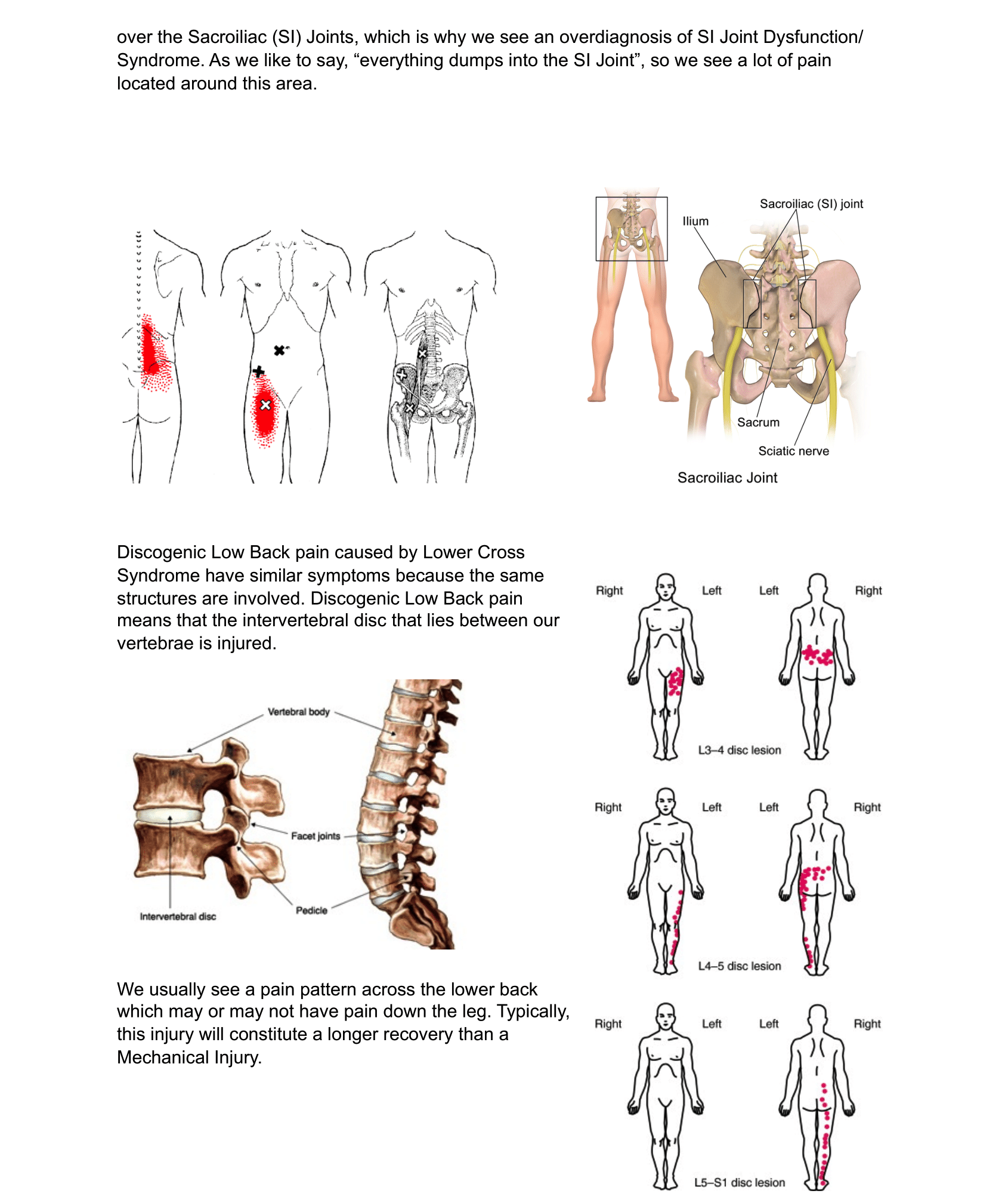 Overuse Injuries - Low Back-3.png