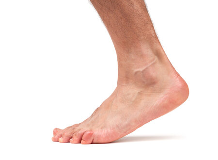 How Much Do You Know About Flexible Flat Feet? — Advanced Feet & Ankle Care