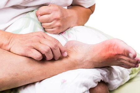 Gout, Your Feet, and You