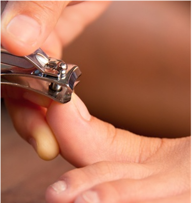 Careful Trimming Can Prevent Ingrown Toenails