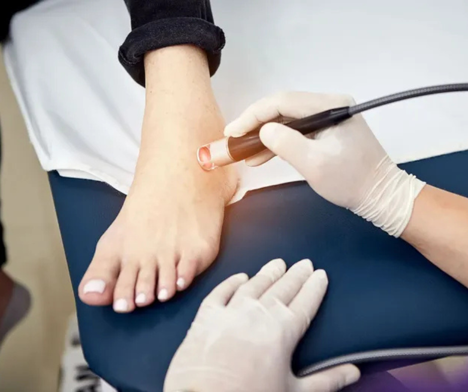 Does Laser Therapy Really Work for Foot Pain? The Remy Laser Guide