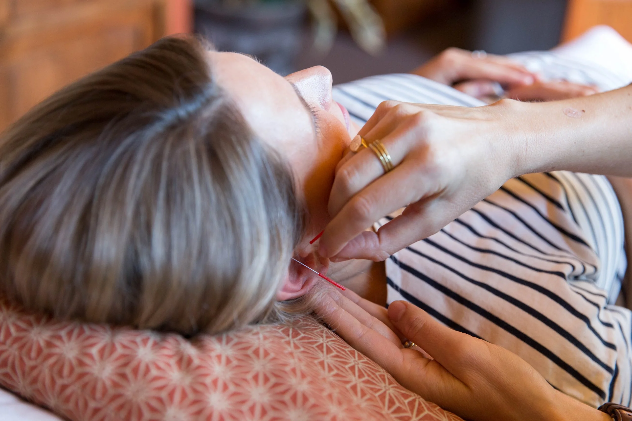 auricular acupuncture ear.jpg