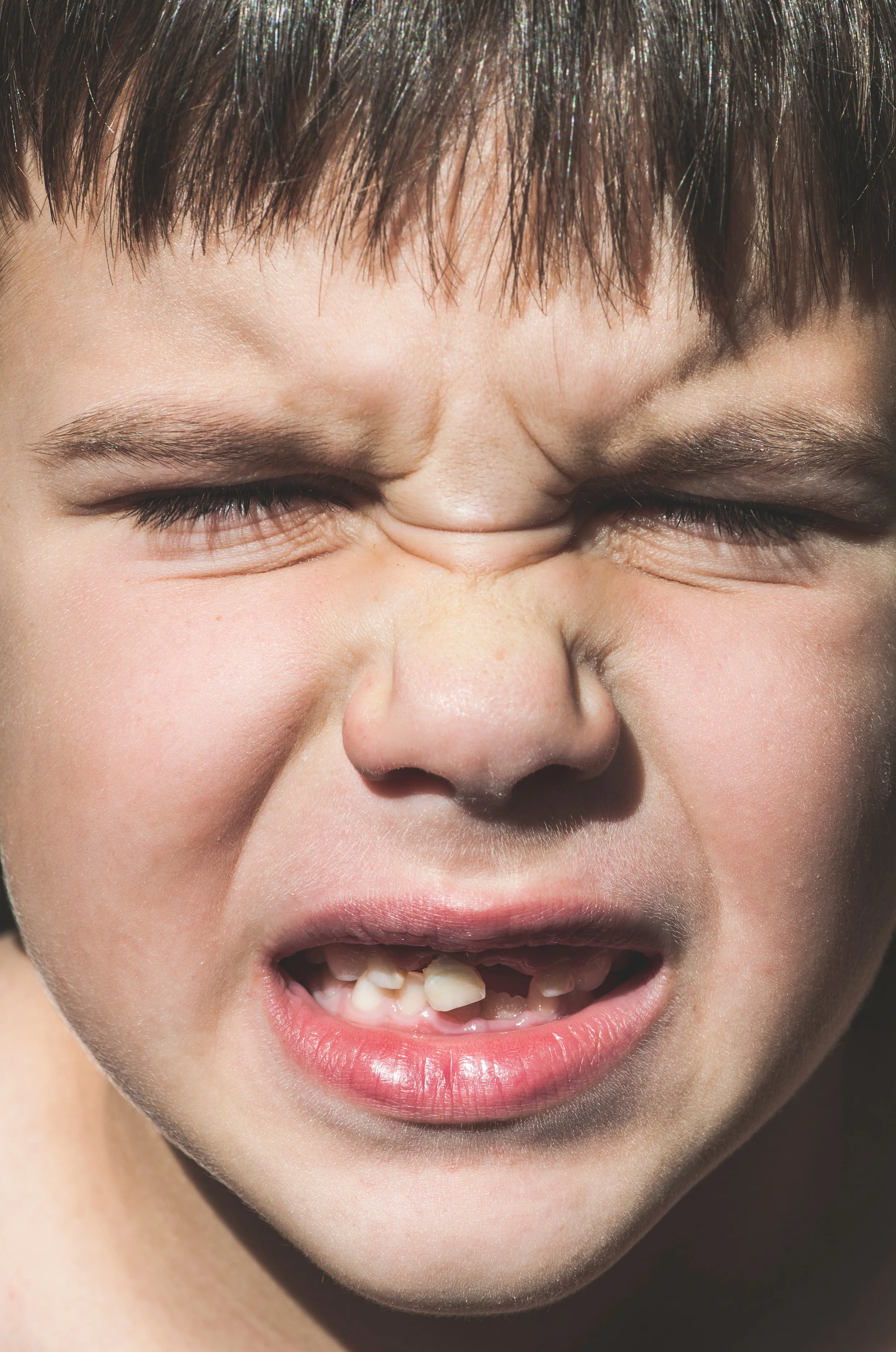Child Shows Missing Teeth.jpg