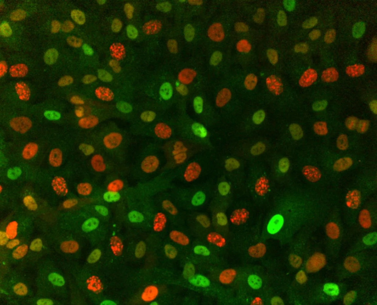 p27 and PCNA.jpg