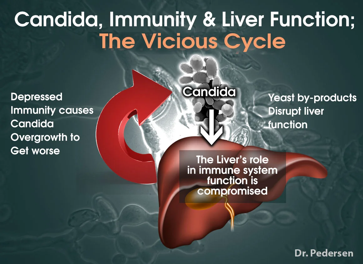 yeast-infection-candida_Liver-Immunity.jpg