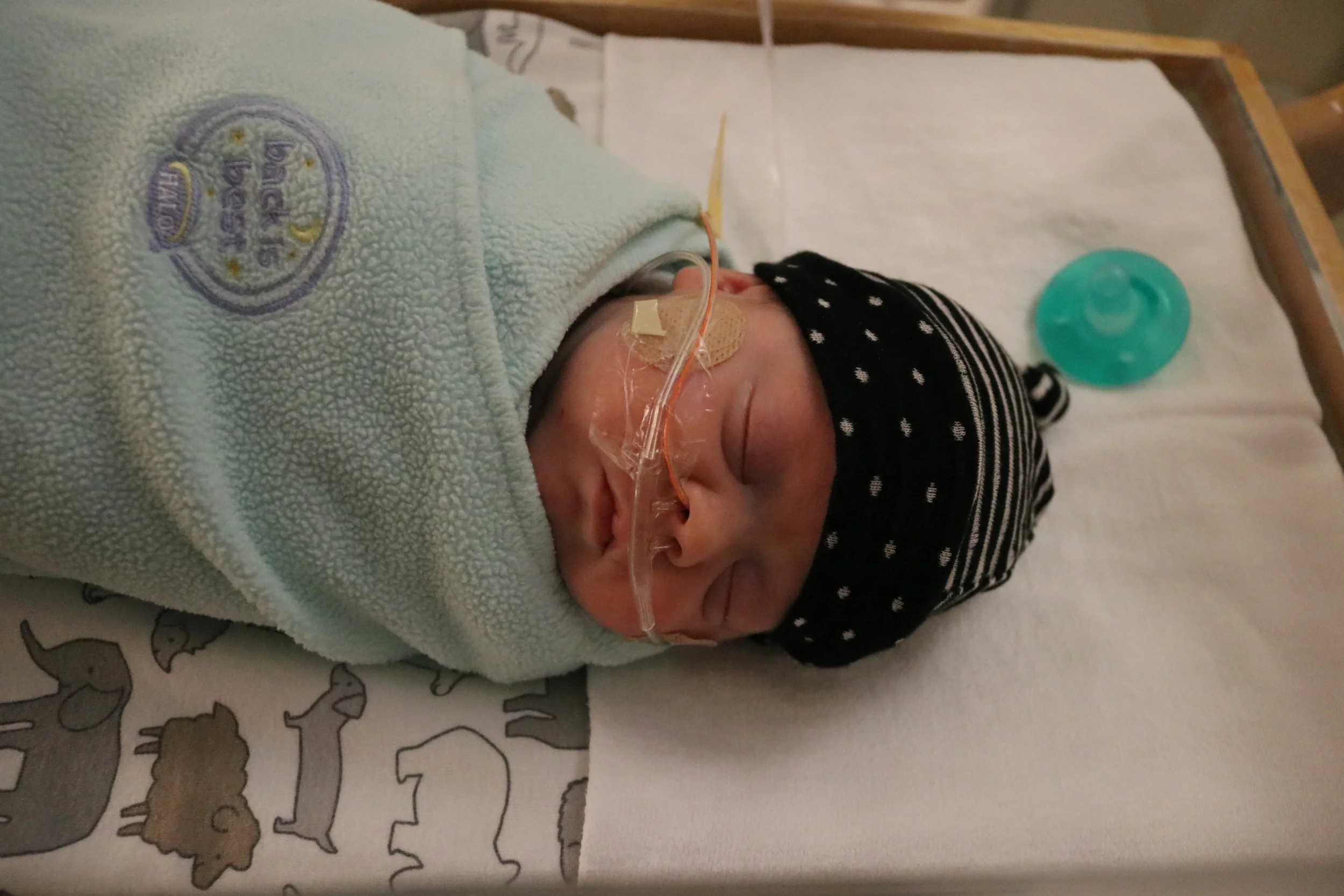 Day 84 – Hernia Surgery