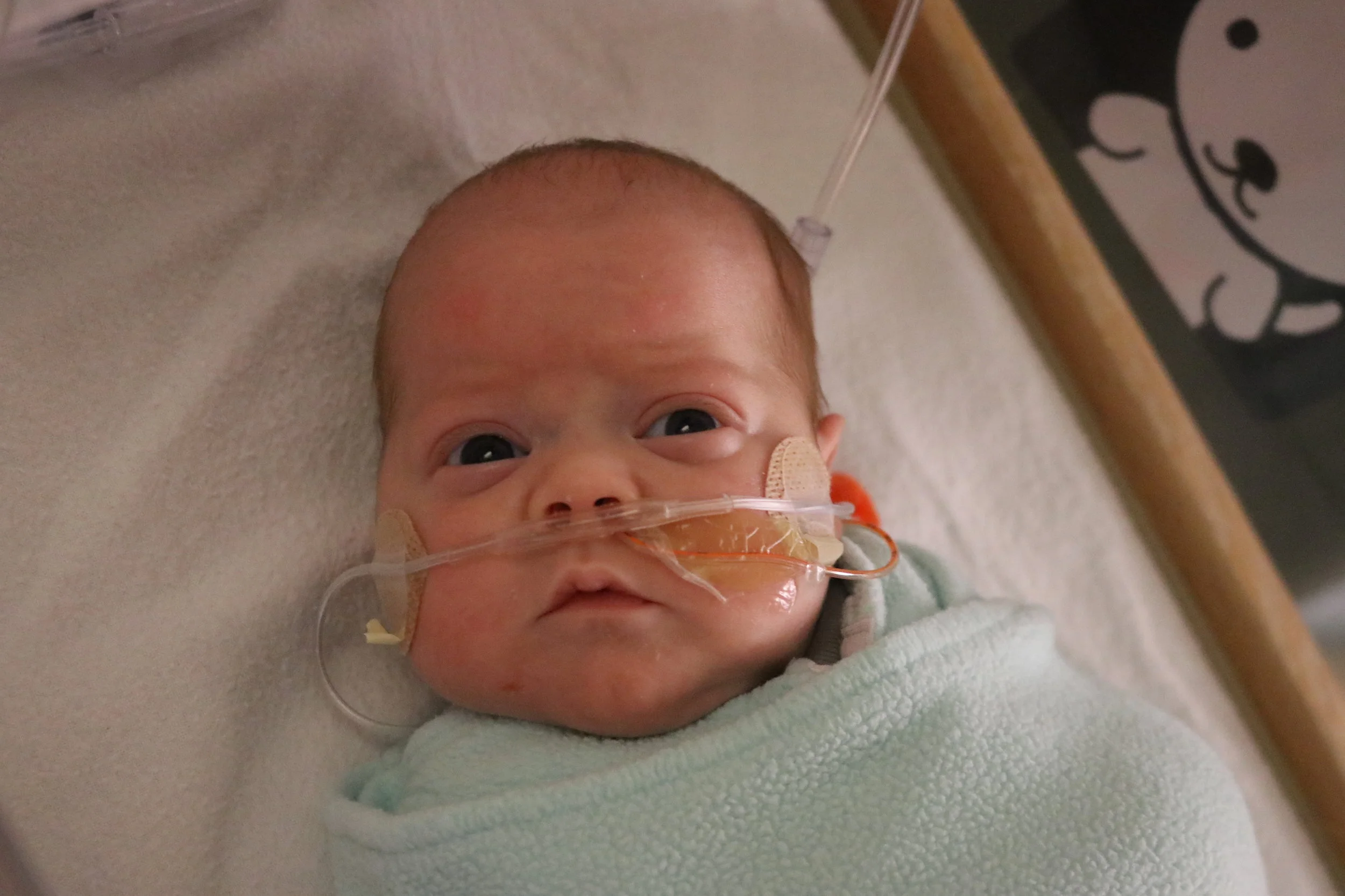 Day 82 – Lex's High Flow Nasal Cannula