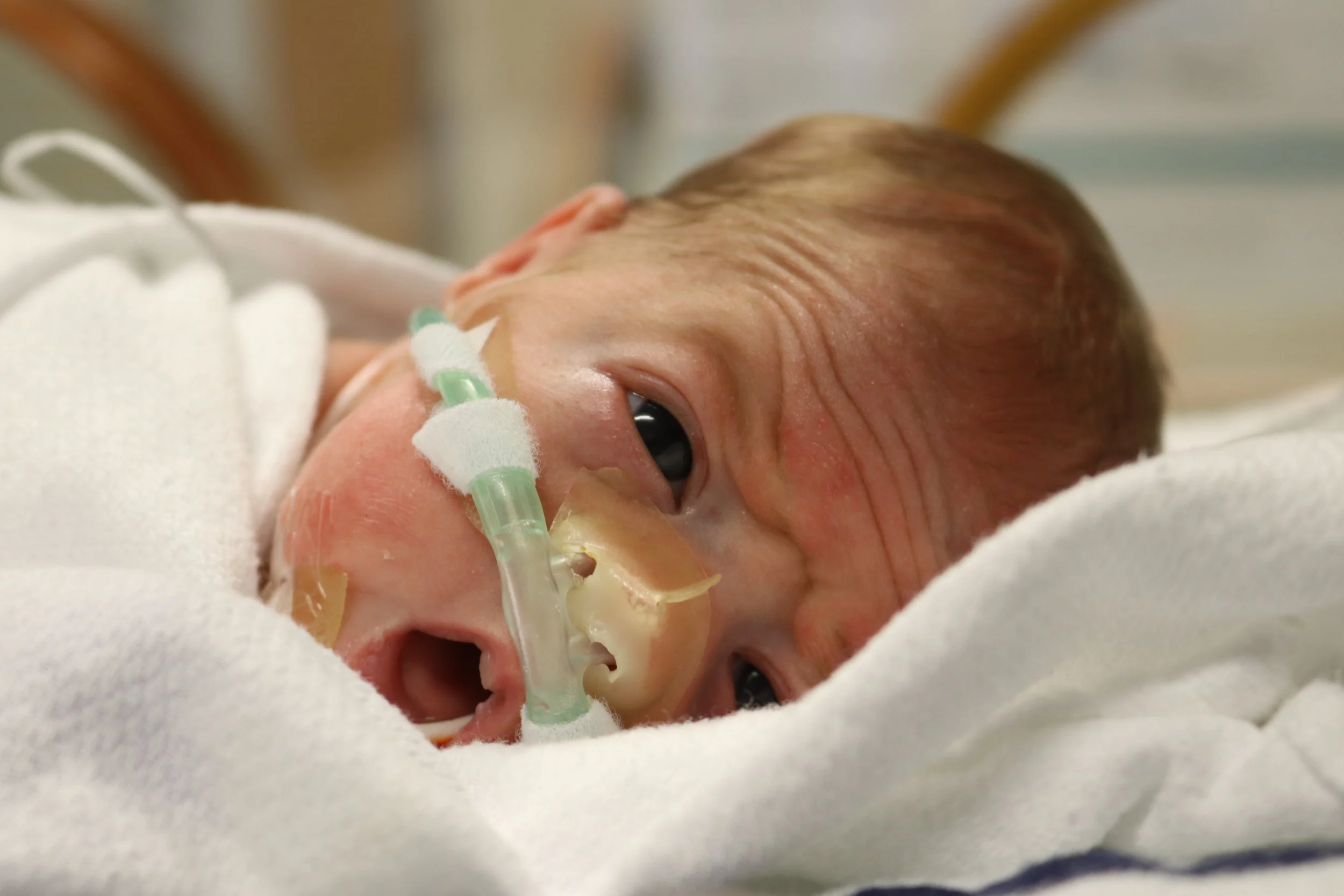 Day 54 – Lex's Respiratory Gains