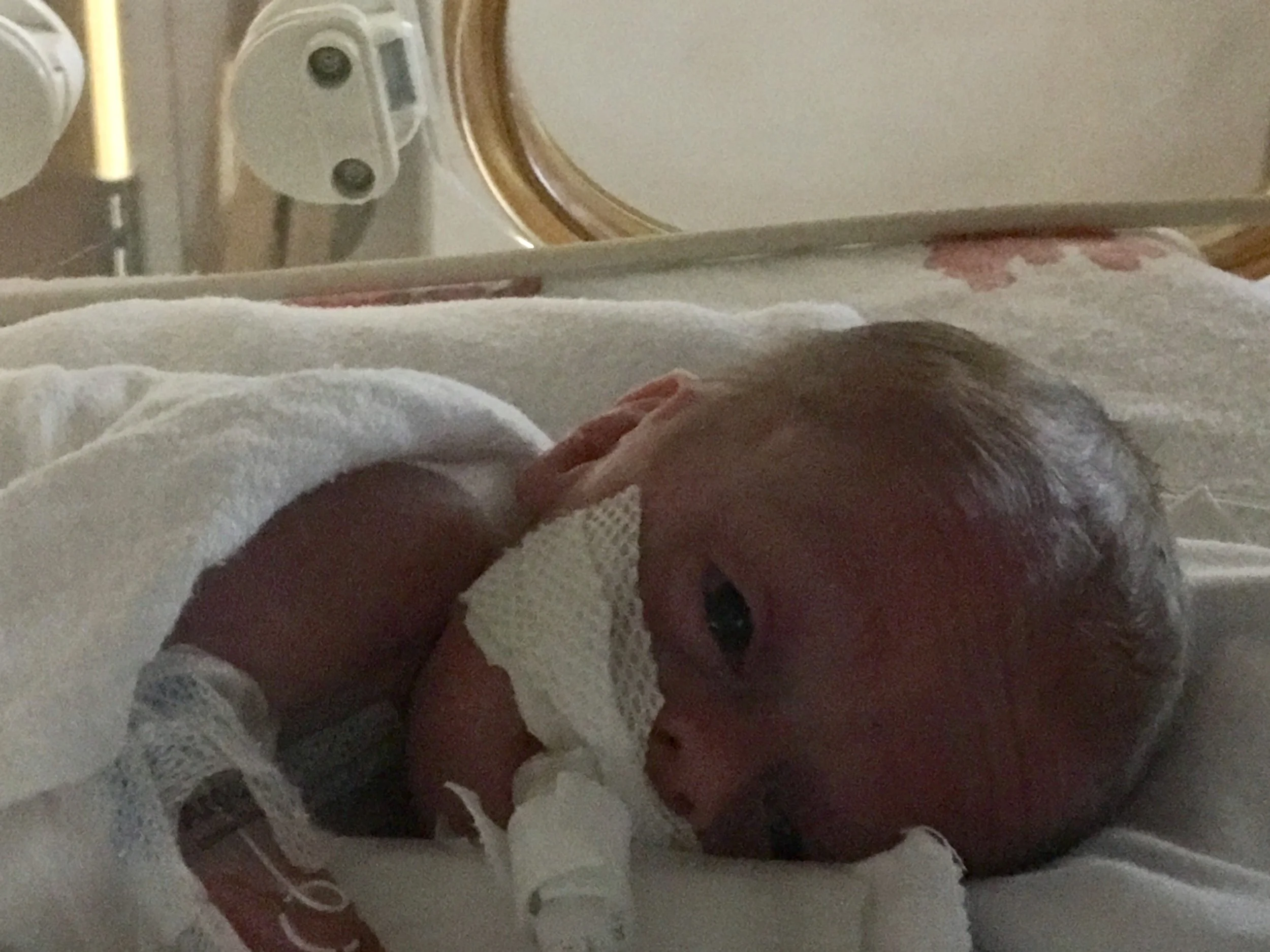 Day 28 - Tomorrow's Neurosurgery