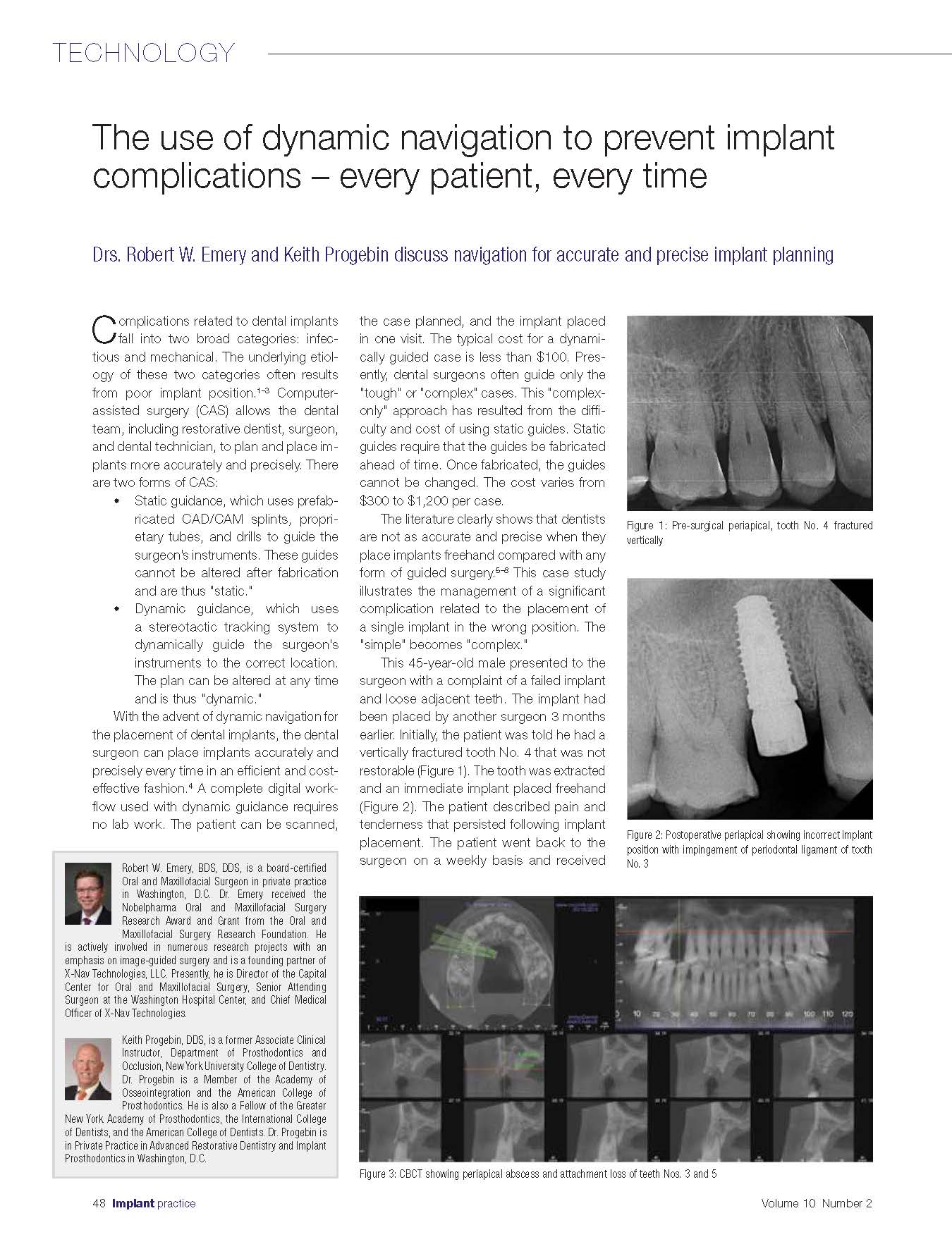 Navigation-To-Prevent-Implant-ComplicationsIPUSQ217_Page_1.jpg