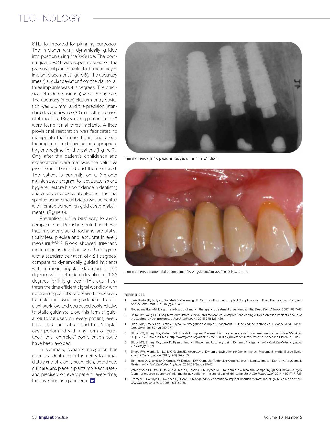 Navigation-To-Prevent-Implant-ComplicationsIPUSQ217_Page_3.jpg