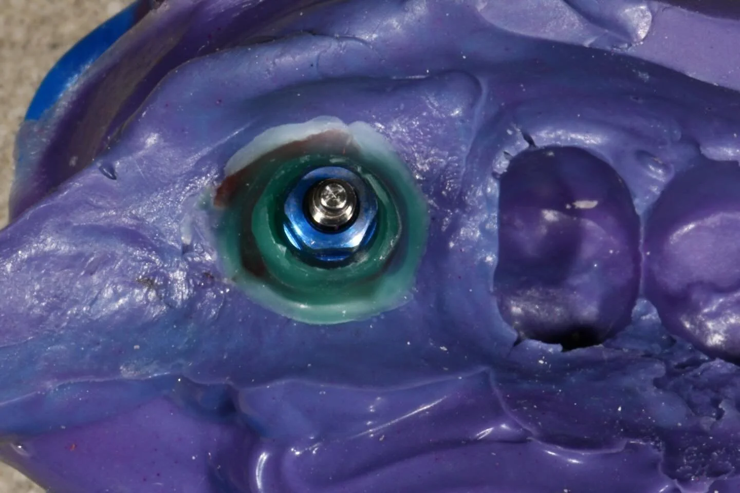 This week we&rsquo;re showcasing a single-unit implant restoration from impression to final abutment and crown.

Clean lab work, handcrafted with a thoughtful design, precise implant placement, and a beautiful emergence profile.

Excellence for every