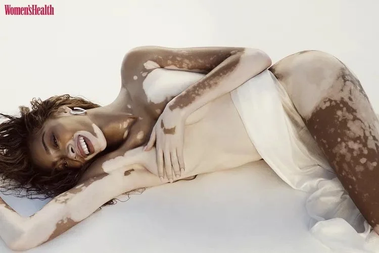winnie-harlow-womens-health-magazine-042523-1-4b072967823e47d3a40d4a6ad58557ac.jpg