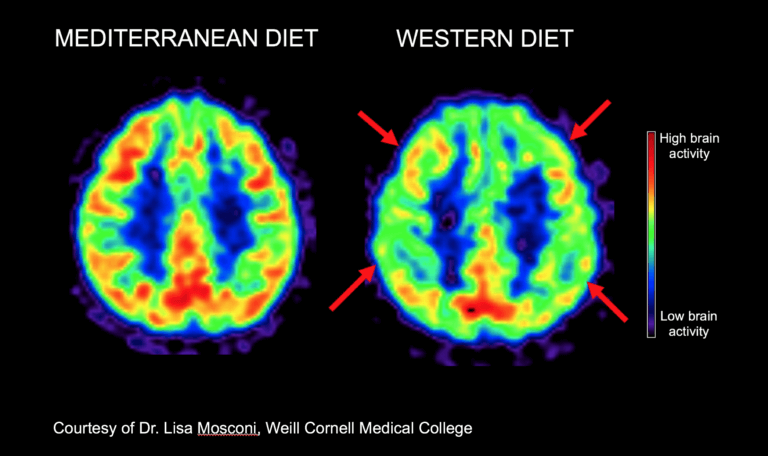 PET-scans_Mediterranean-vs-Western-diet-768x456.png