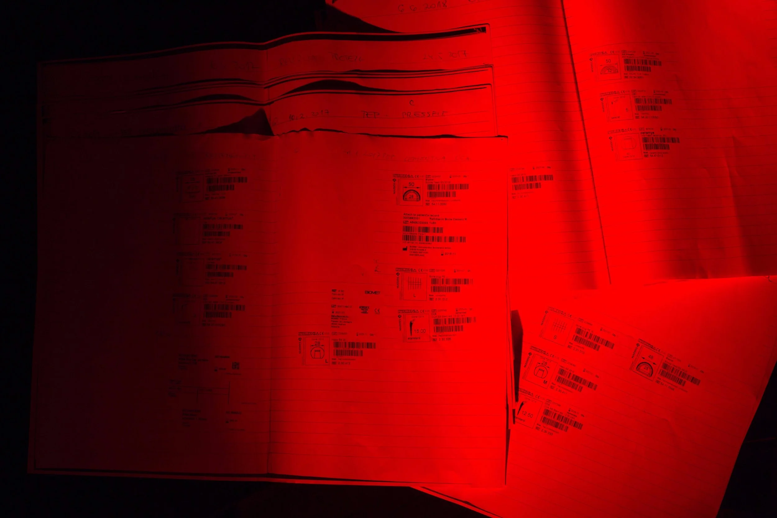 Podatke o ortopedskih vsadkih imajo v zvezkih