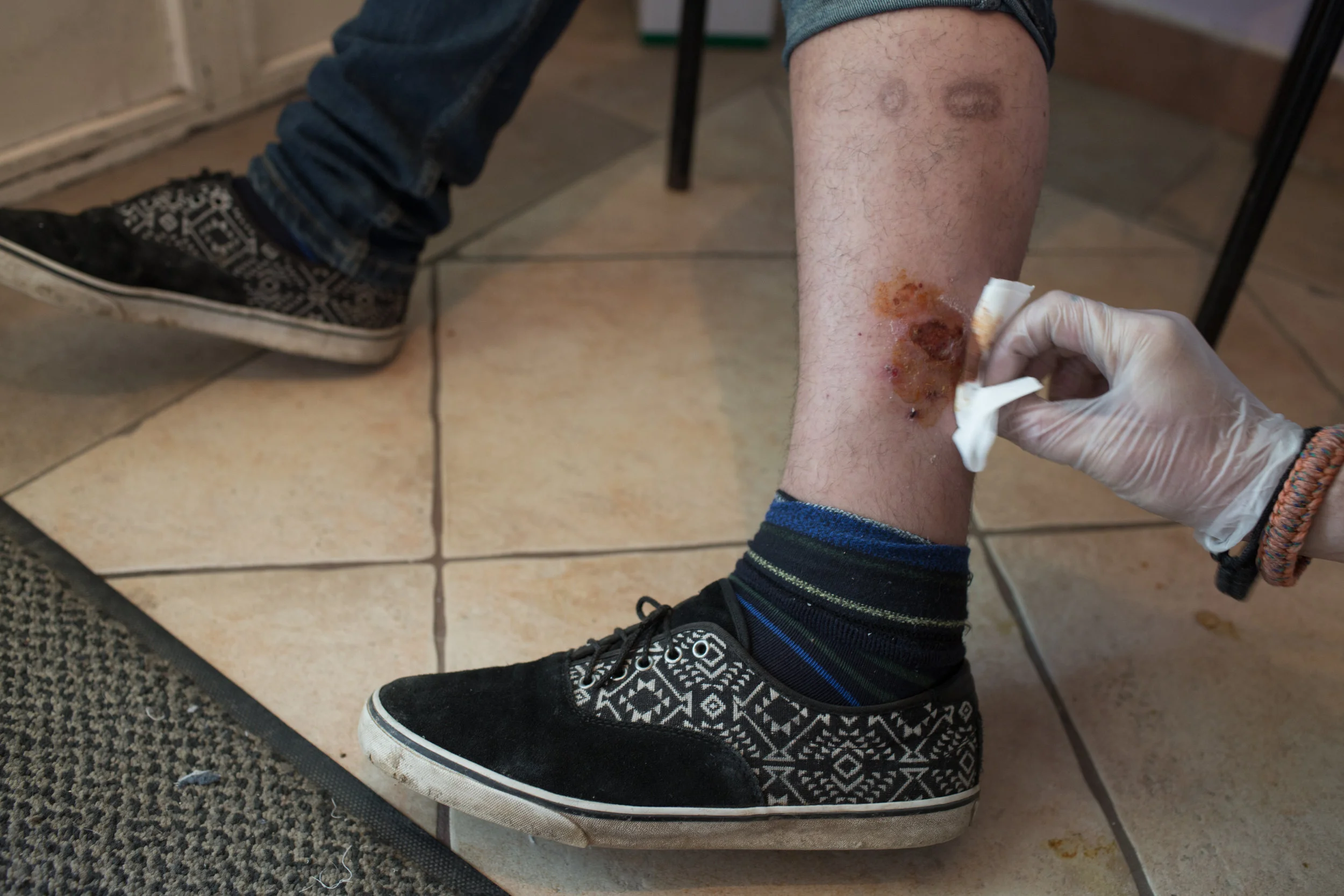  Mnogi migranti prijavljuju da je policija do njih nasilna. 