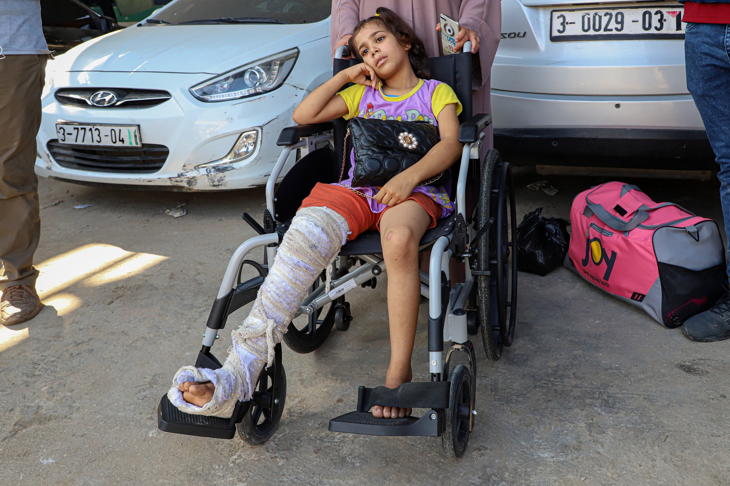  Po konvenciji Združenih narodov o otrokovih pravicah imajo otroci pravico do zdravstvene pomoči in rehabilitacije. Begunskemu otroku, ki je zaradi kateregakoli razloga brez družine, pa ta pravica ne preneha. Na fotografiji je poškodovana deklica na mejnem prehodu Rafa med Egiptom in Gazo. Foto: Xinhua/STA 