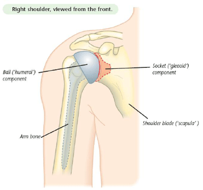 Shoulder Arthritis The Southampton Shoulder Clinic Highly Qualified And Experienced Medical Professionals