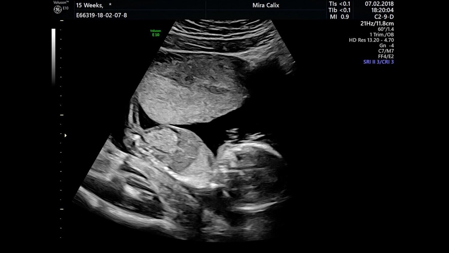 Mira Calix, 16 weeks (still), 2020. Image courtesy of the artist