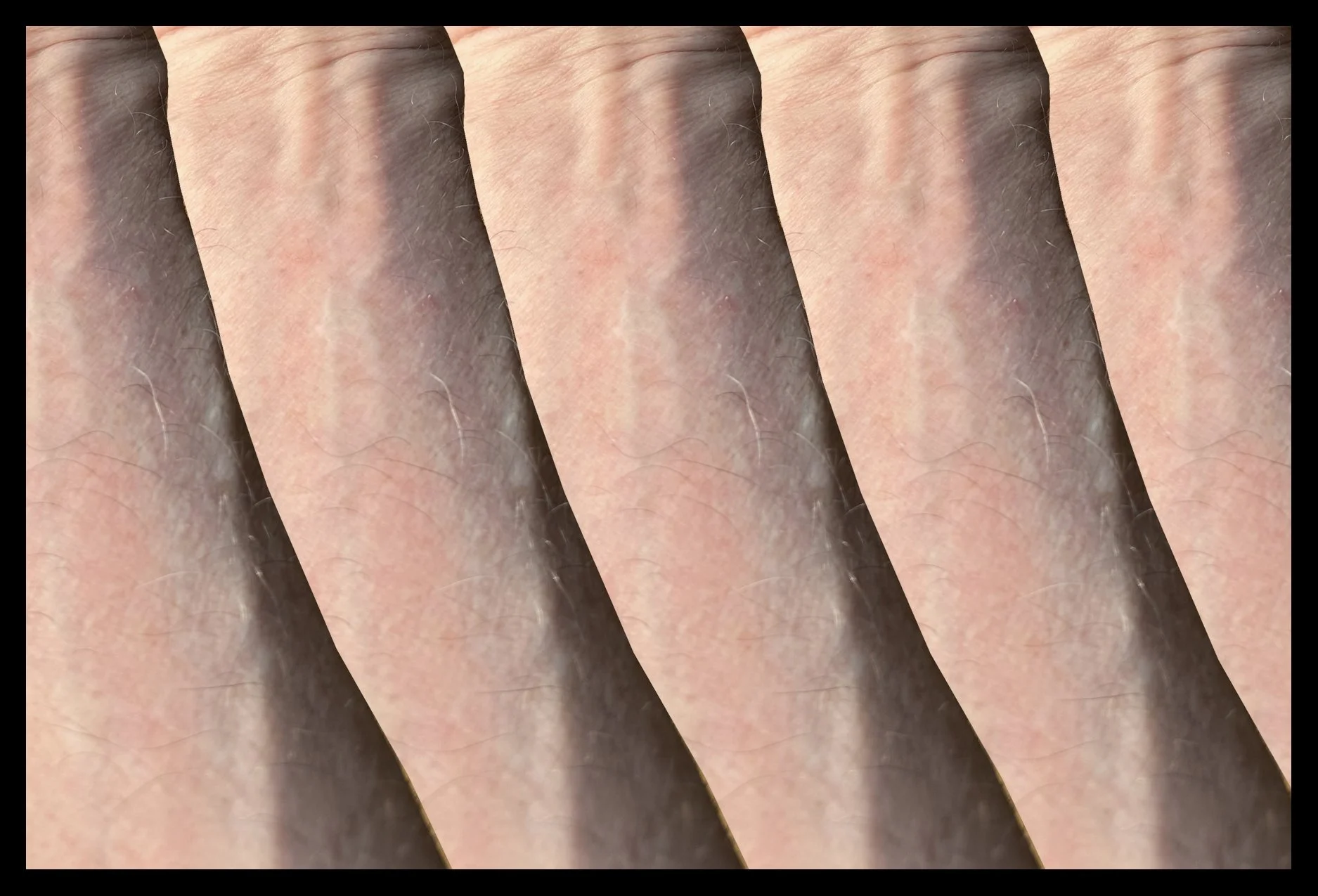 Arms