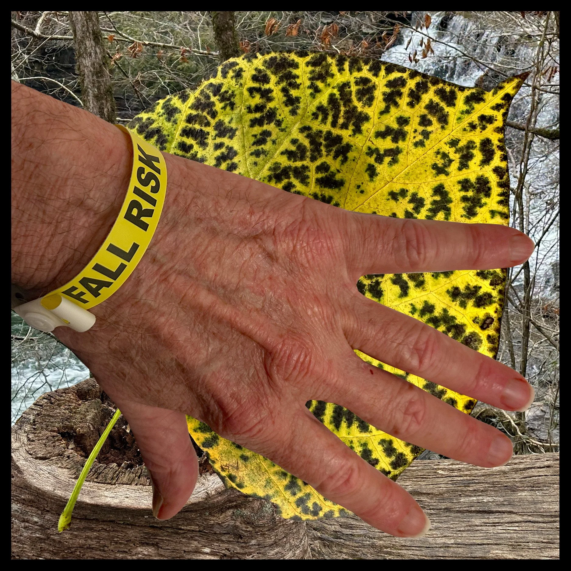 Fall Risk
