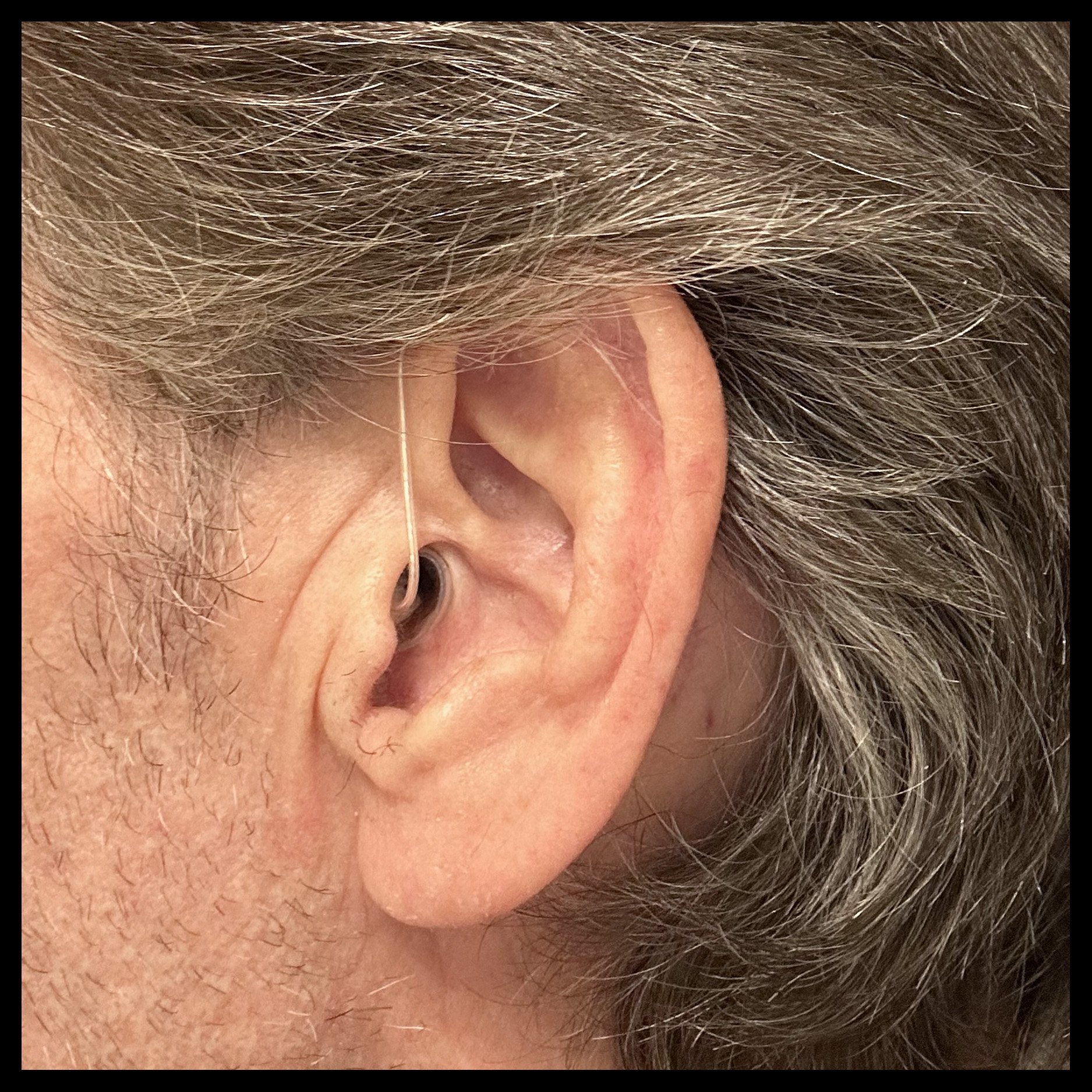 Ear