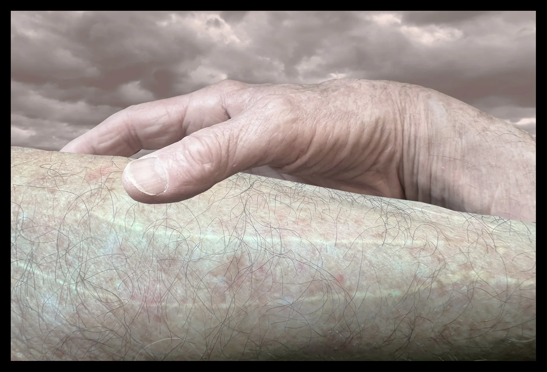 Scars On Arms