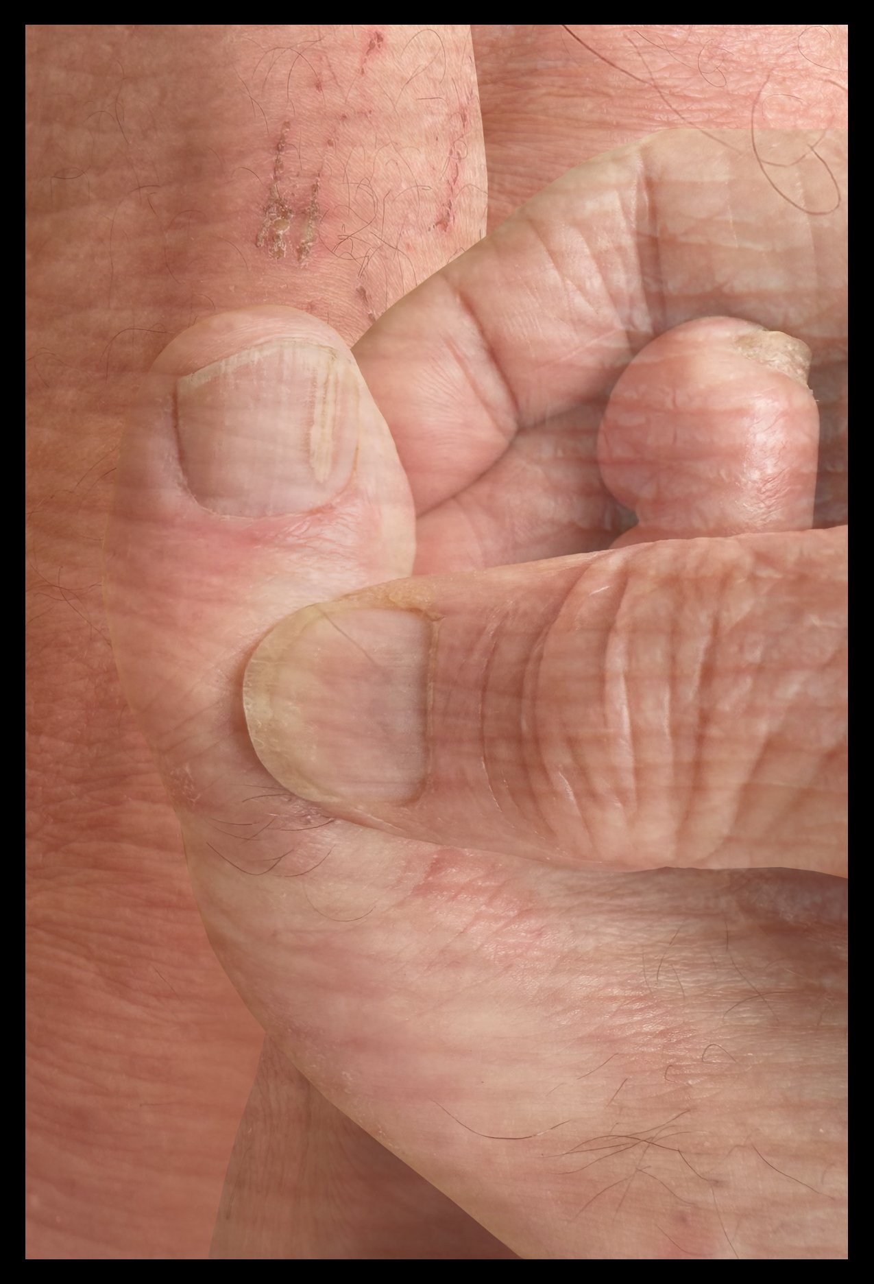 hand and toe cover