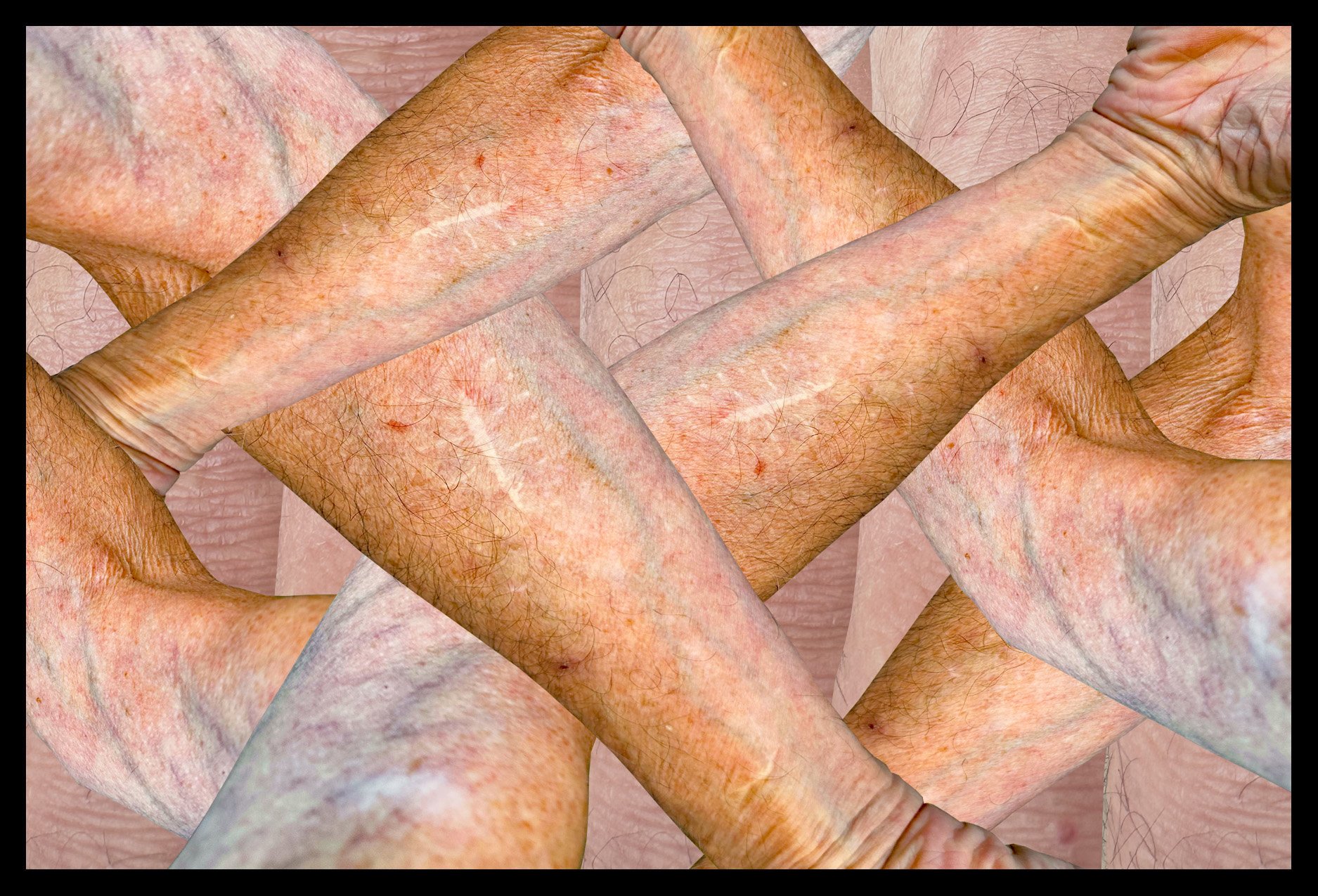 Tangled Arms