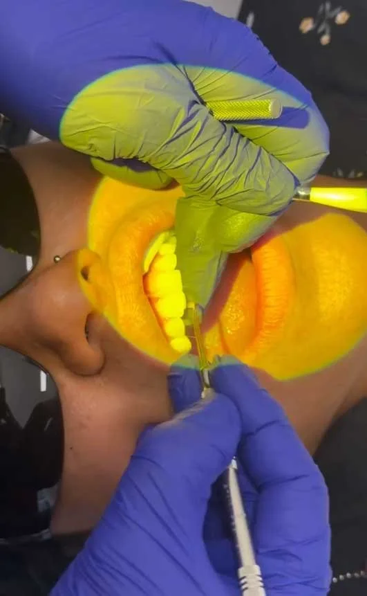 A New Smile Transformation Coming to Life in Wagga