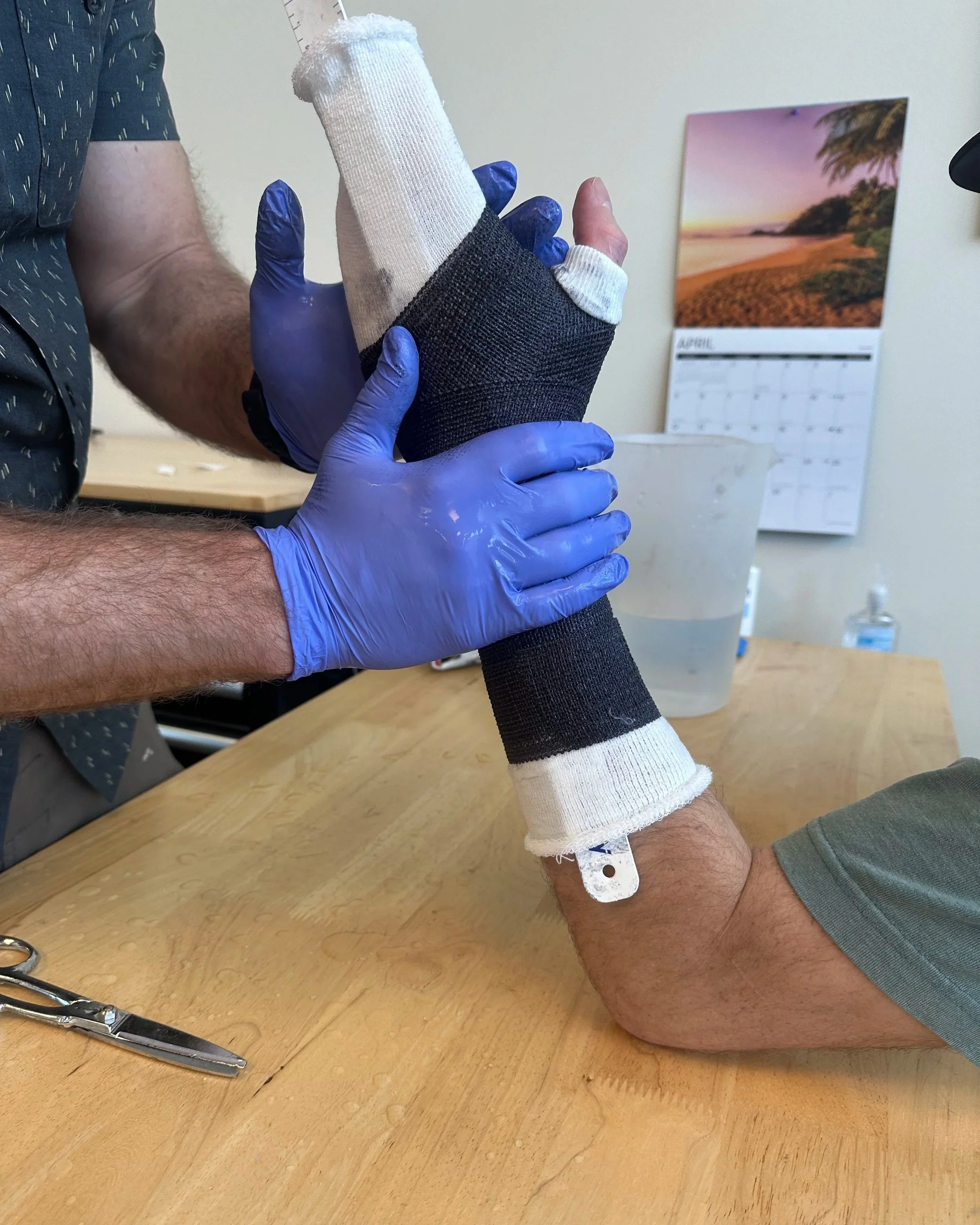 splinting at gabel PT