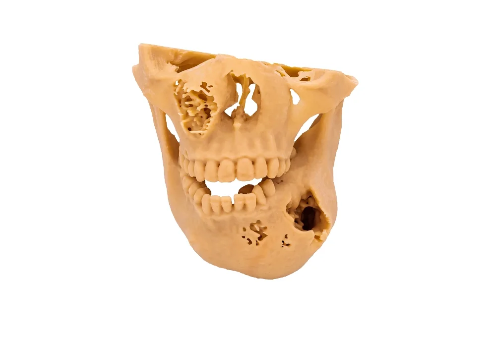 Facial reconstruction