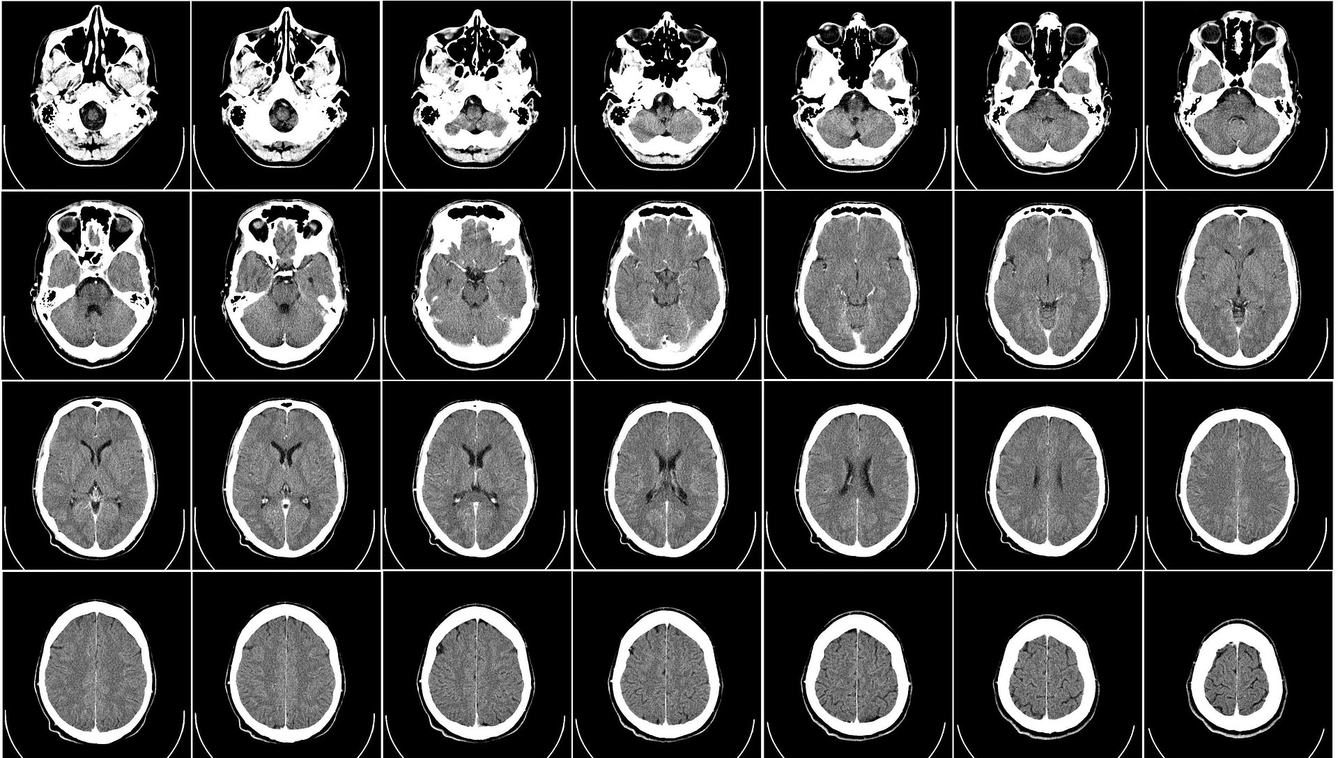computer-tomography-62942_1920.jpg