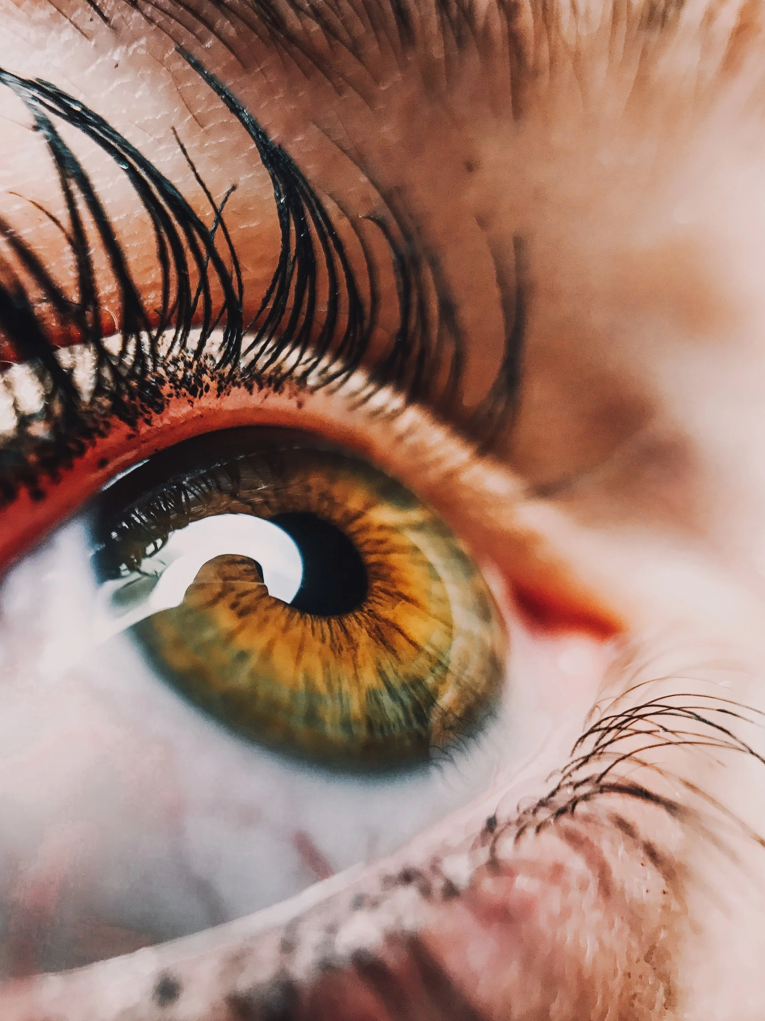 Astigmatism