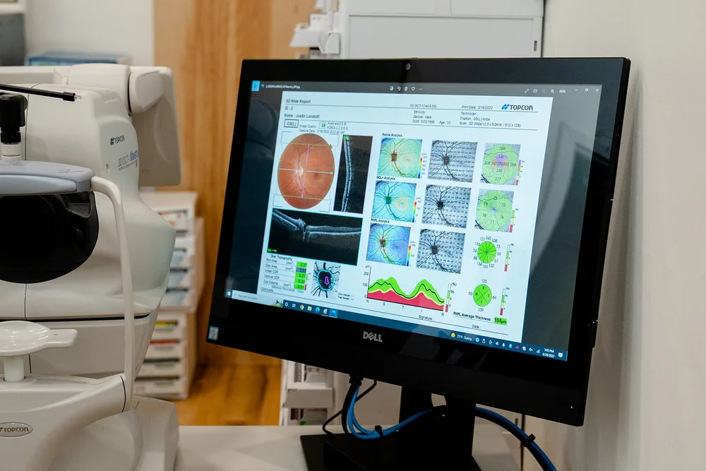 Cornerstone Eye Care Dr. Landolfi a Princeton Eye Doctor