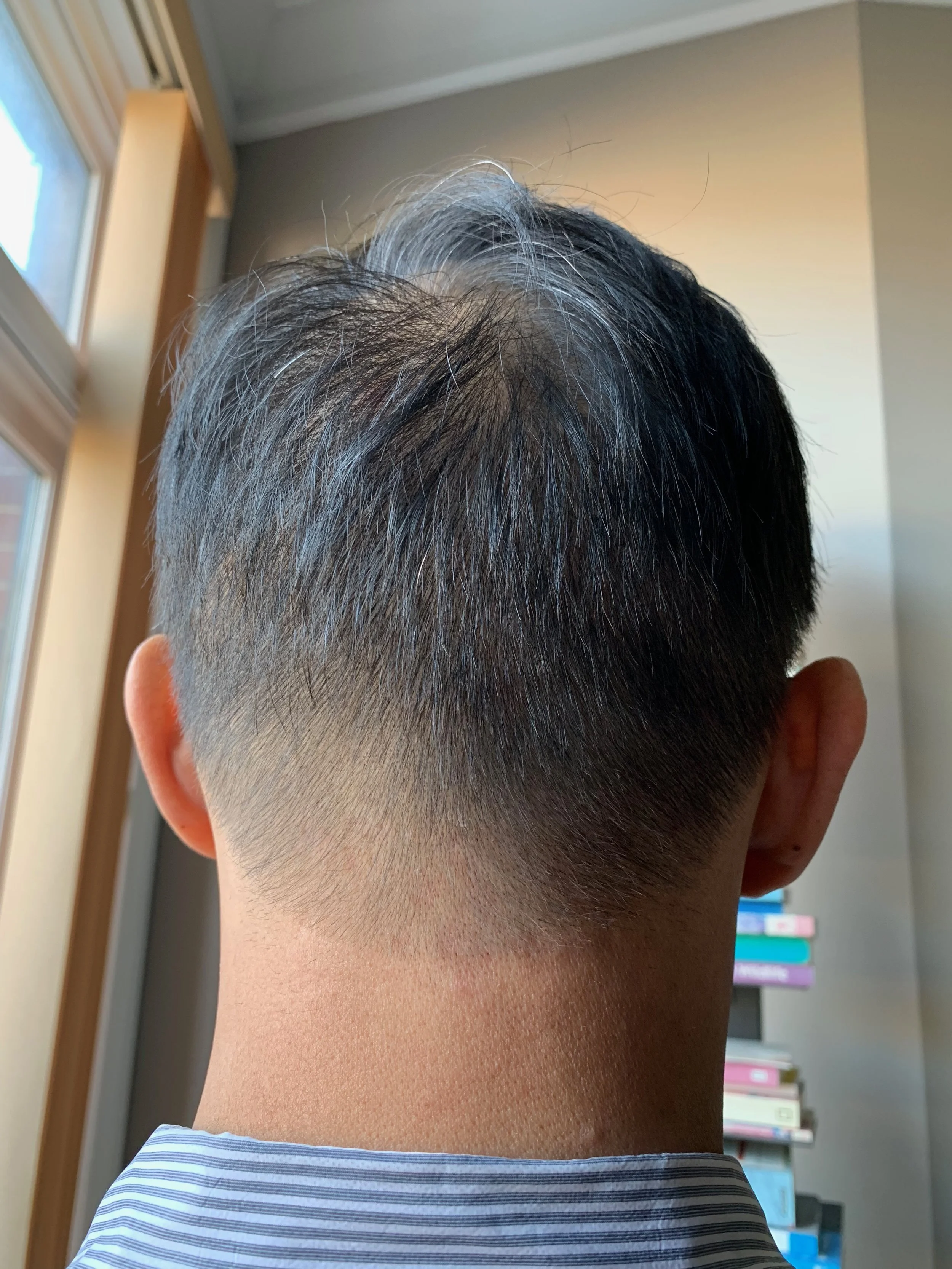 My hair is still thin in the back, but starting to grow back