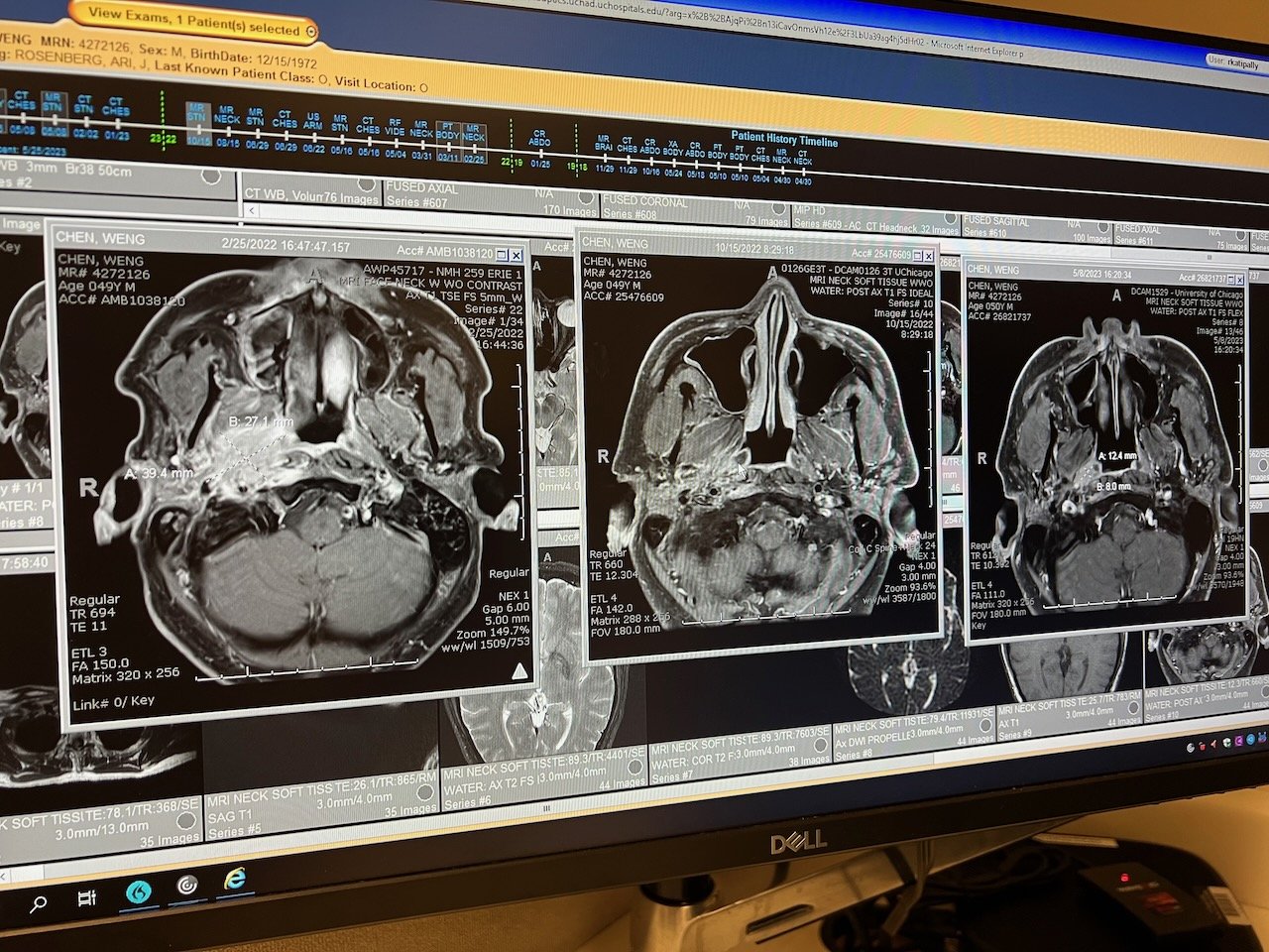 MRI comparison