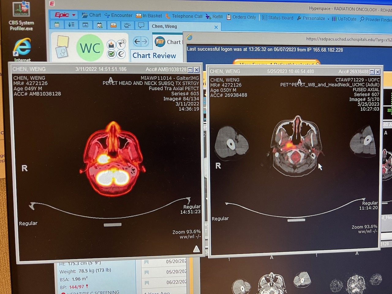 PET scan comparison