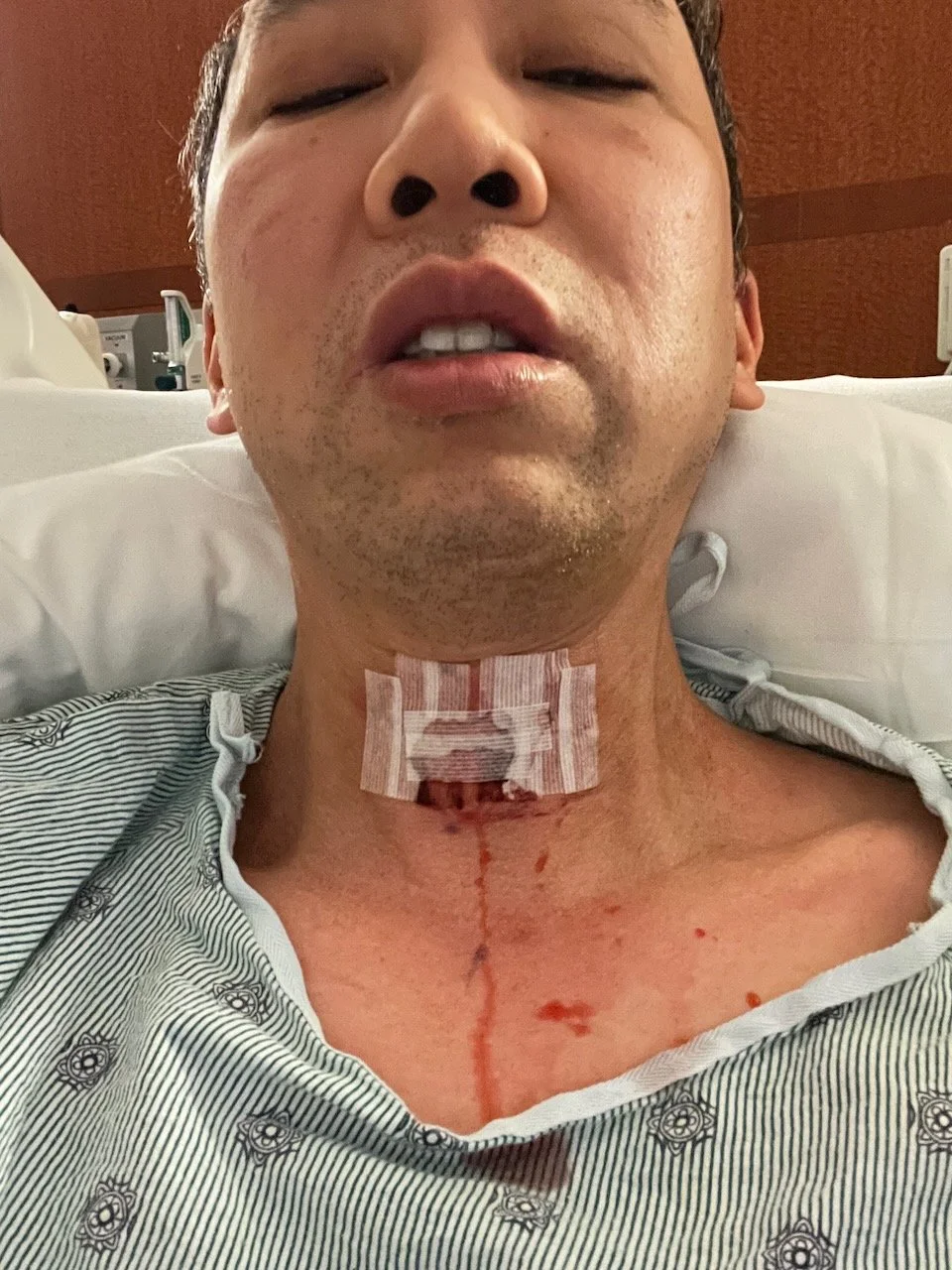 First time seeing the surgical site