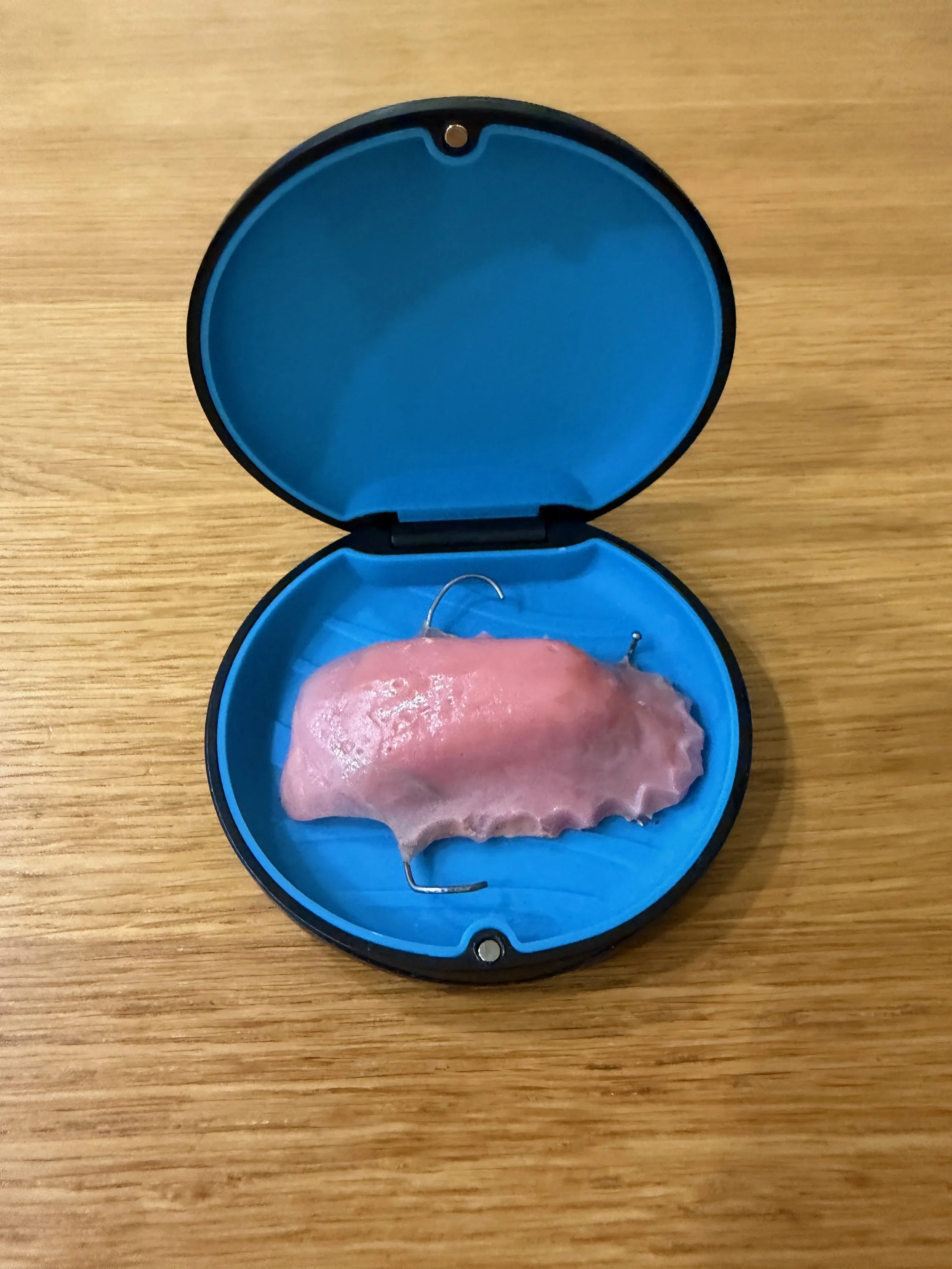 Eating Challenges &amp; Obturator