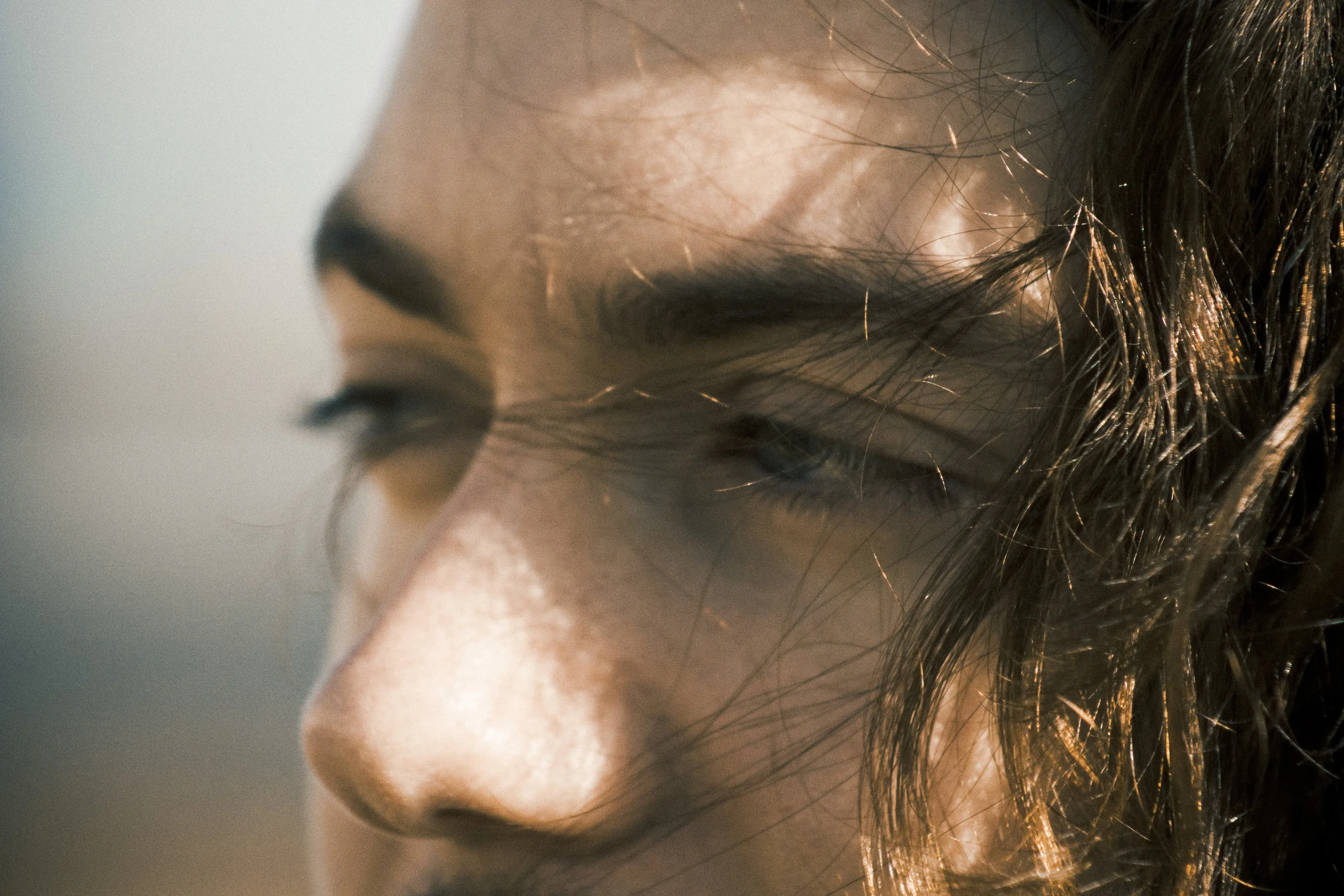 Nose Job Problems: My nose is swollen after my cast came off!